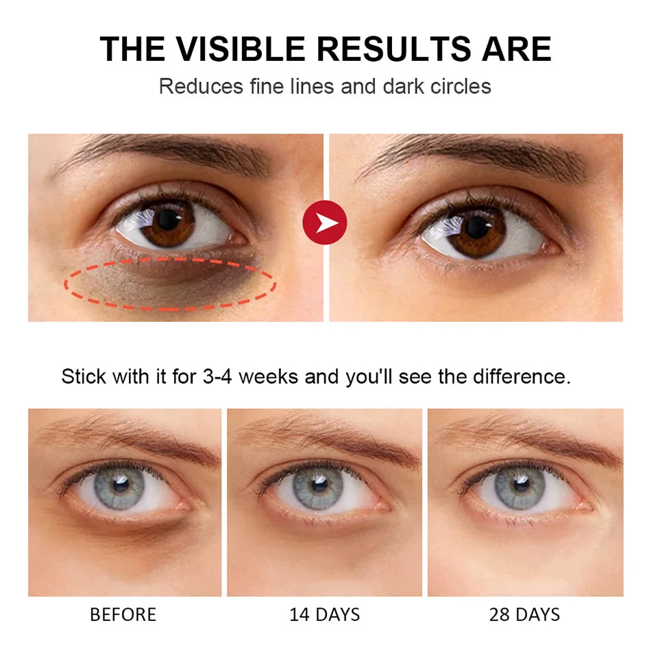 Bright Lift Eye Stick