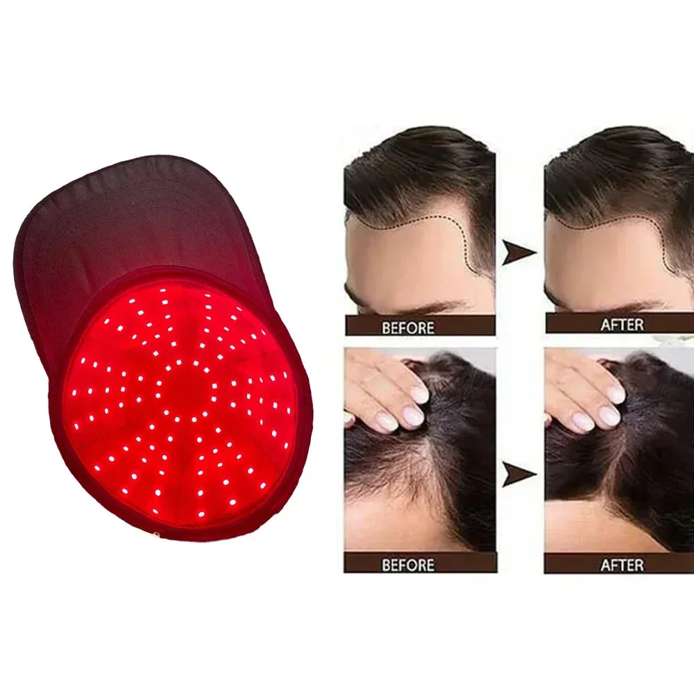 LumiGrow Red Light Cap